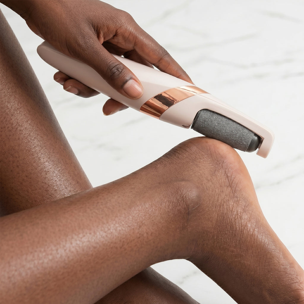 Electric Foot Callus Remover